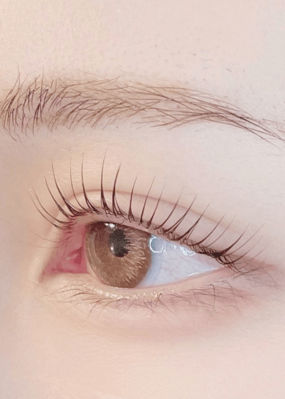 Top Brow
