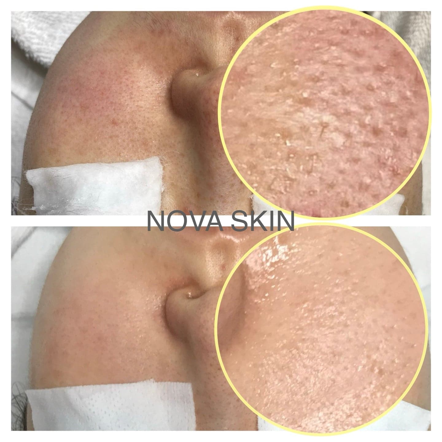Novaskin · photo 4