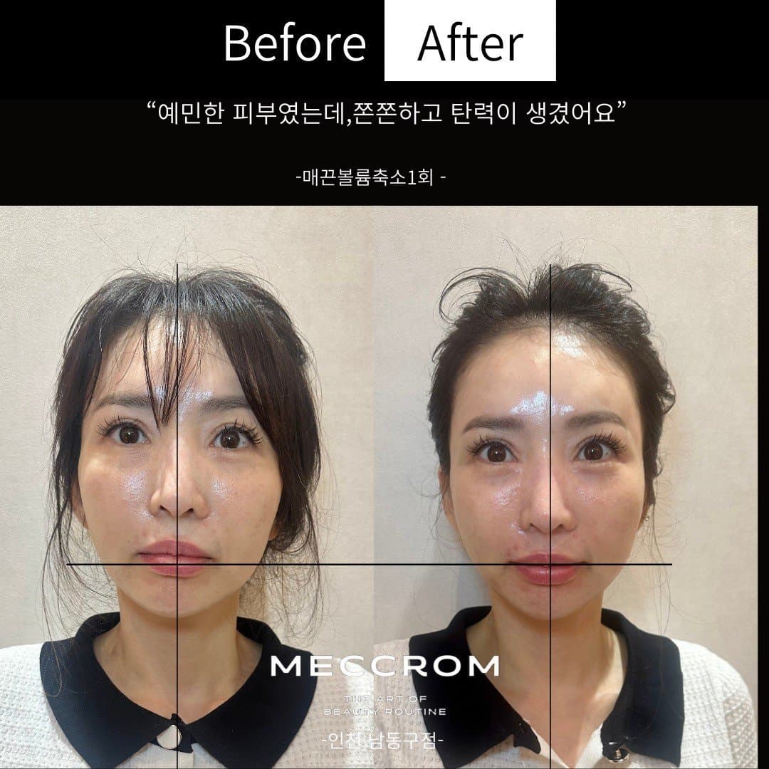 Meccrom Incheon Namdong-gu · photo 1